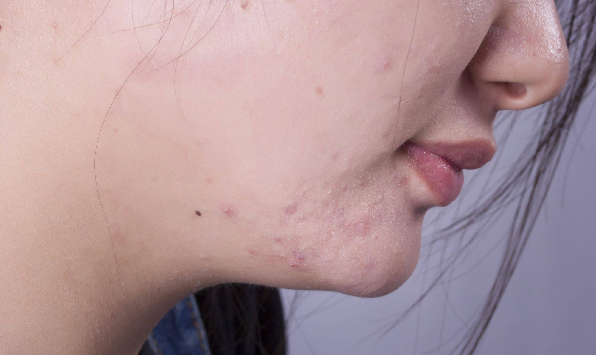 饮食|肝不好的人，通常有哪些共性？避免肝病找上身，该怎么改善？