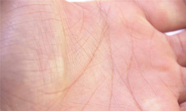 进行|肝硬化是“哑巴病”？身体早就给出警告，别一再错过