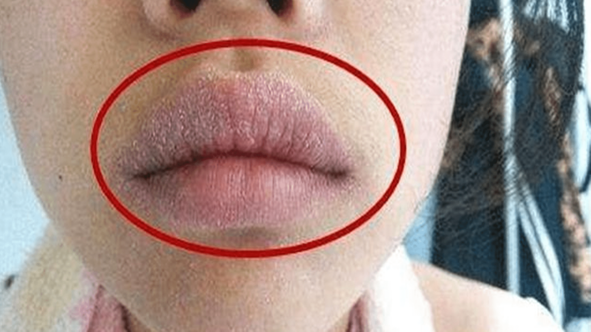 效果|宝宝嘴唇干裂起皮，母亲非常担忧？正确护理比喝水管用