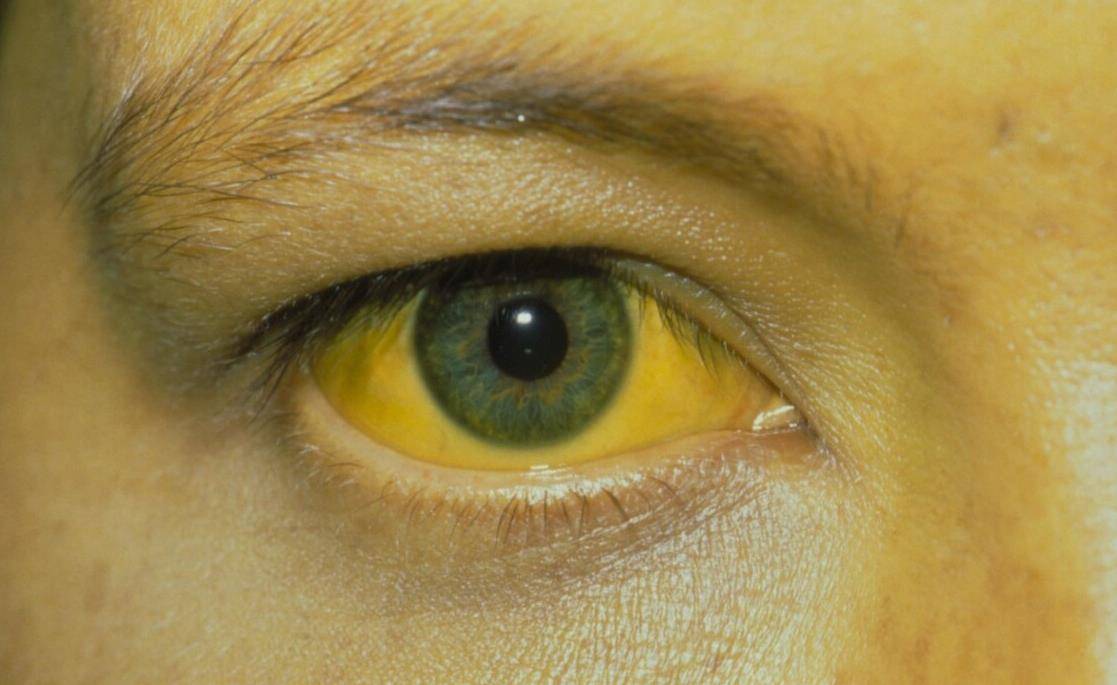 肝脏|肝好不好，看2个地方，谨记3个字，常做4事，肝会慢慢变健康