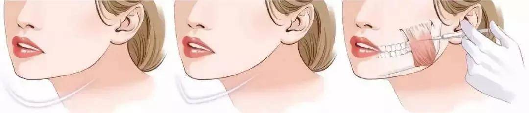 严重嘉宜老师小课堂|：这些陋习，让你变丑的速度超过99%的同龄人！