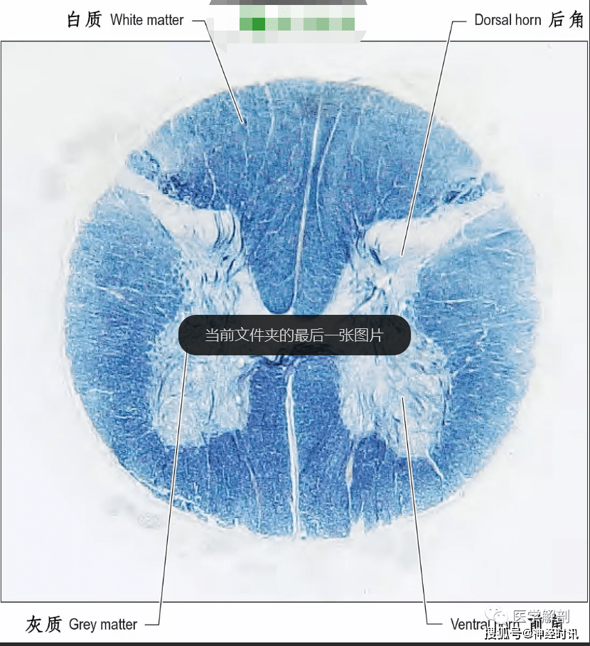 神经纤维横切面手绘图图片