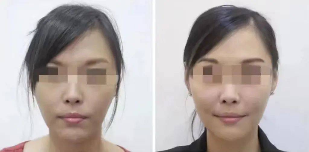 白天“再生医美”热度不减，精通TA的咨询师都年入百万了....