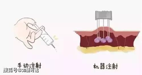 瑞蓝花几万块打水光惨遭毁容?真假水光，没搞明白前劝你别去踩雷......