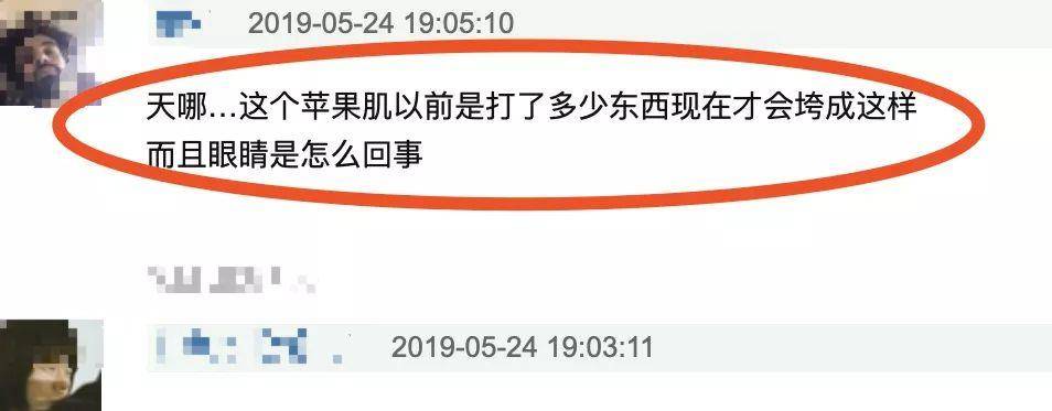 都靠郑爽近照状态不佳，疑似出现整容后遗症！