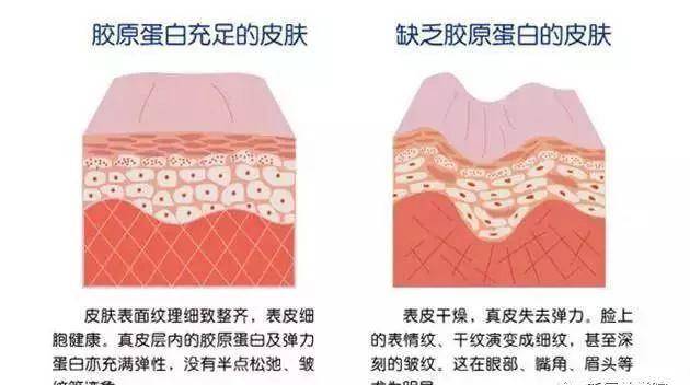 小狐狸清纯又妖孽的“小狐狸”气质成新宠？张嘉倪宋轶还能红