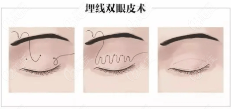 单眼皮颜值加分项：如何造就灵动双眼