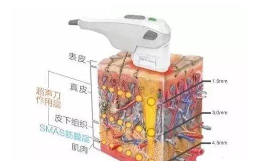 面部41岁赵雅芝古装照上热搜不老容颜惊艳一方！40岁女人如何抗衰老？