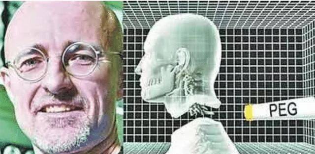 换头手术成功了能活几天 c35687b17c874c6fb7631abed70cfc54.jpeg