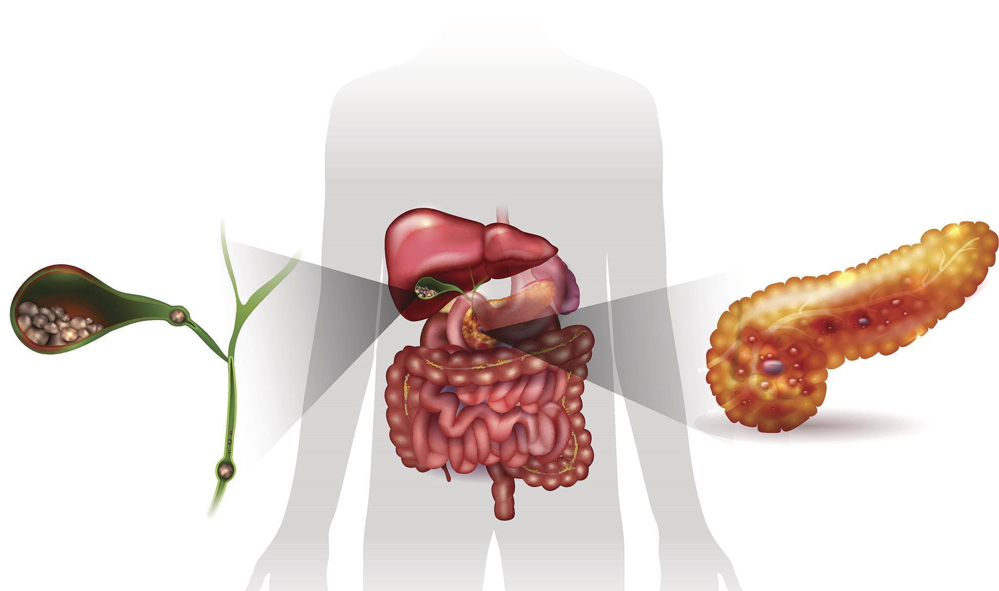 肝脏|老是出现肚子痛是怎么回事？可能是这4大脏器“生病”了
