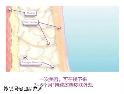 玛吉明星都在做的热玛吉？不推荐你做，理由只有一个（不是贵）