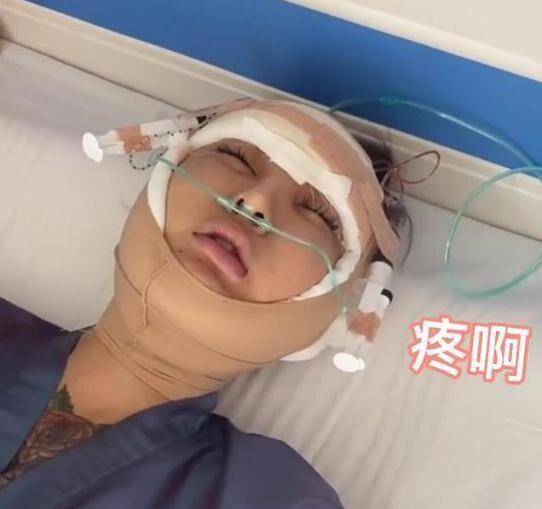 因为网络红人“桃花宝宝”，花费百万多次整容，手术之后笑容僵硬