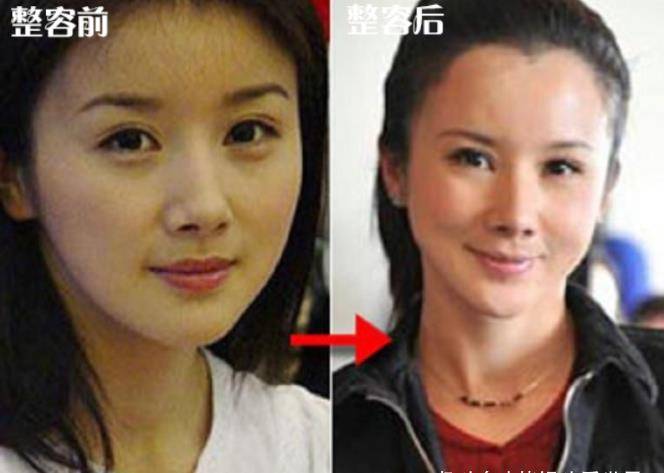 萧蔷明星们的大规模“翻车”现场，如何整容变成毁容的