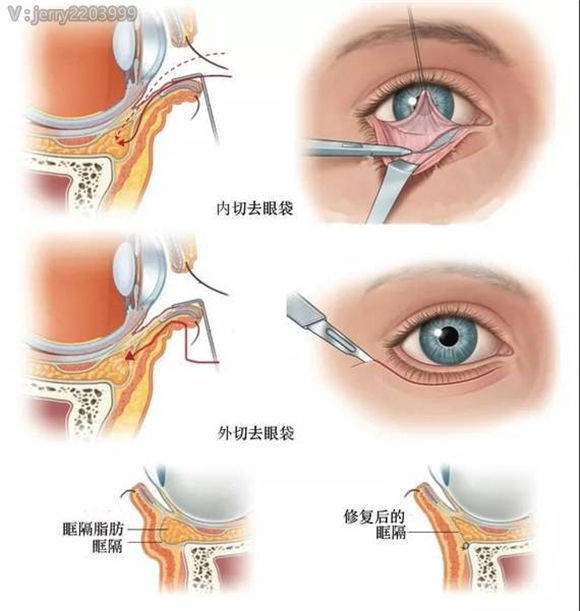 方法艾玛珂儿丨眼部系列问题，如何快速解决？