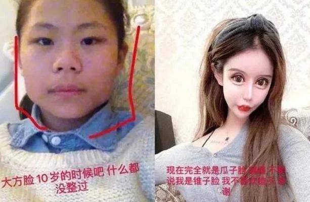 形象还记得13岁开始整容，花费上百万整容60次的女孩吗？现状令人唏嘘