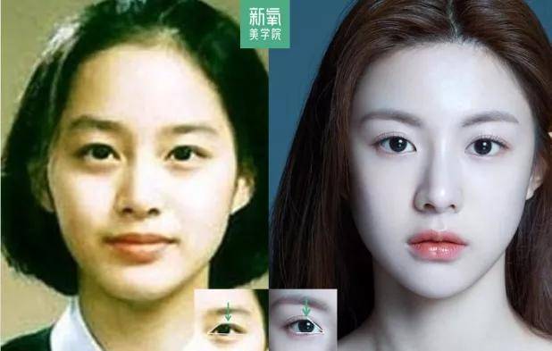 度数很多人都混淆了眯眯眼和小眼睛的区别