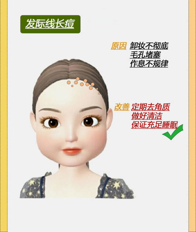 脸部脸部不同位置的痘痘解析，如何改善呢？