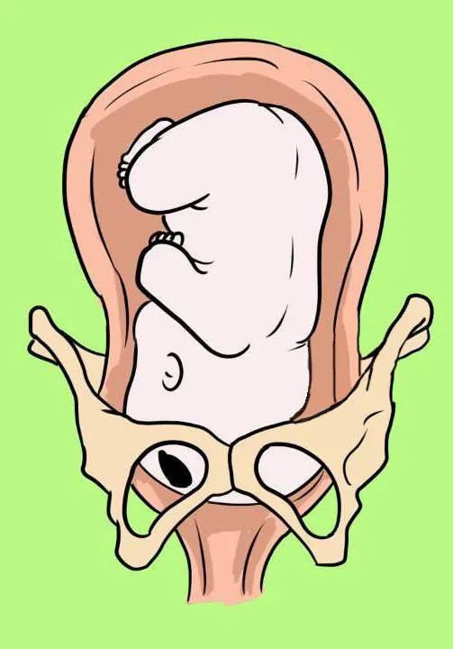 胎儿入盆是要生了吗快到预产期的孕妈看过来