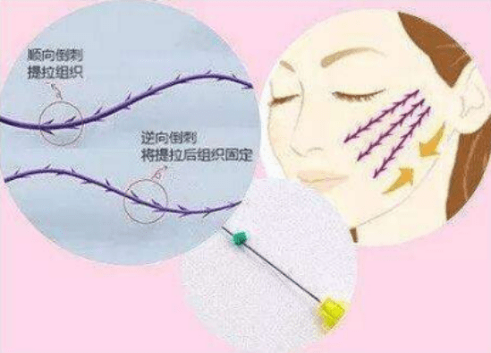 因为不要垮脸，要青春，那就快来get这个抗衰秘笈吧