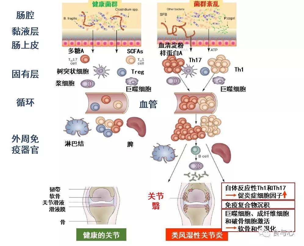 甲状腺|肠漏，你必须知道的热知识（二）