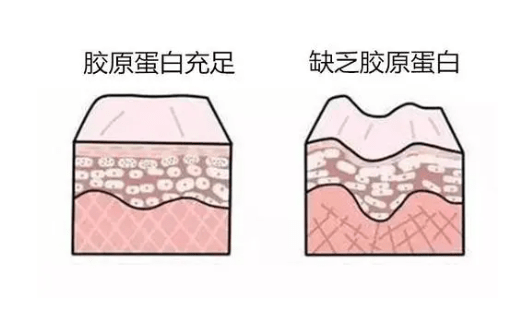 补充淮树抗衰三部曲丨直击衰老根源 重塑肌肤年轻密码！