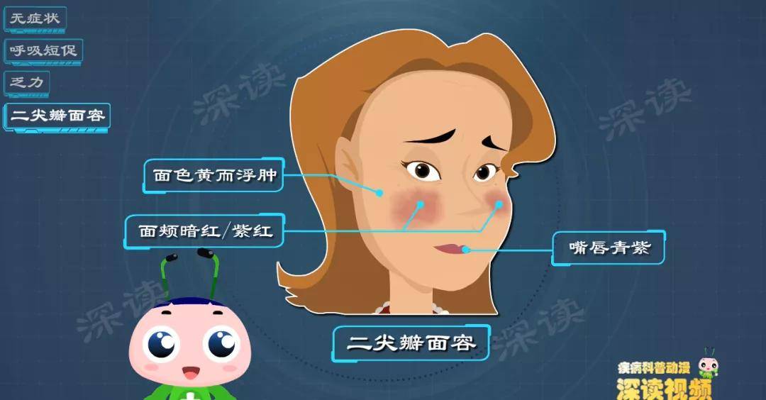 万恶的风心病,每年祸害28万人!_风湿性_心脏_瓣膜