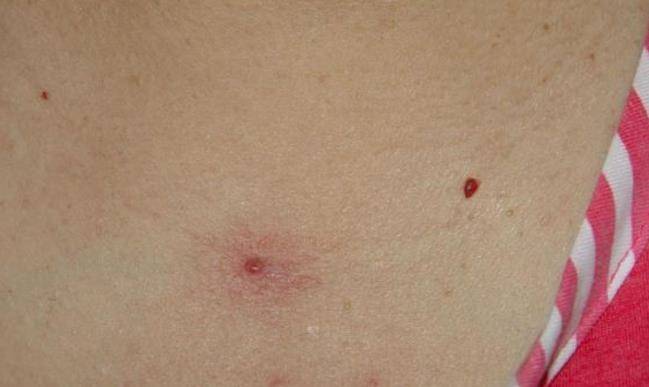 双生痣是什么预兆 d3d17b039f7a4f64987a6876d7bb0c6f.jpeg