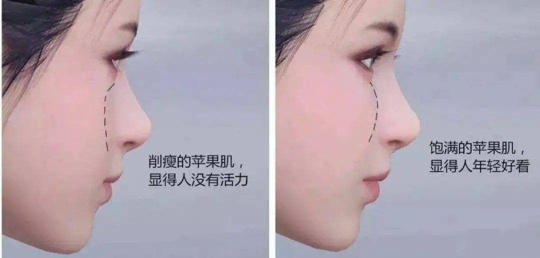 下巴霸屏朋友圈的“骨相美” 面部设计法 | 咨询师必备