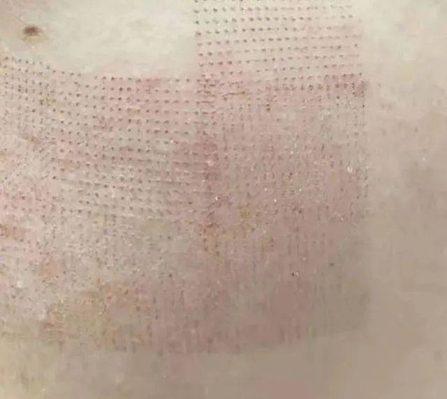 急救春节假期一周倒计时！时间紧迫，做点什么项目可以快速变美？