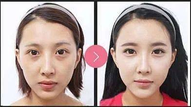 急救春节假期一周倒计时！时间紧迫，做点什么项目可以快速变美？