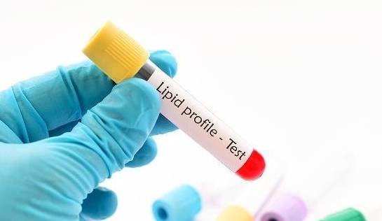 血脂怎么在家检测 5c174aa454df4b349416e2dc5e542a04.jpeg