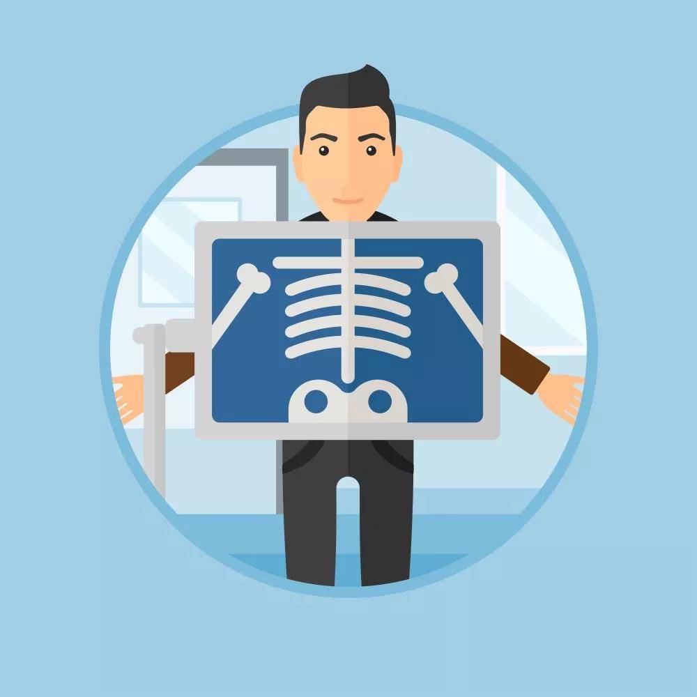 肺部疾病早筛高手胸部ct检查帮助准确诊断