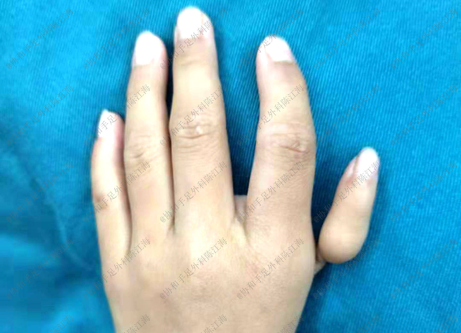 中指朝上手势什么意思（中指朝下对着人啥意思）