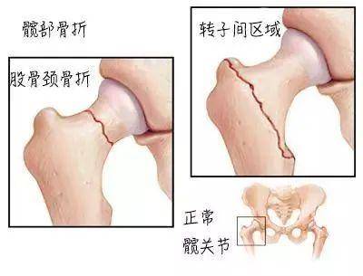 红楼|重庆骨科医院：重庆红楼医院查得准治得好