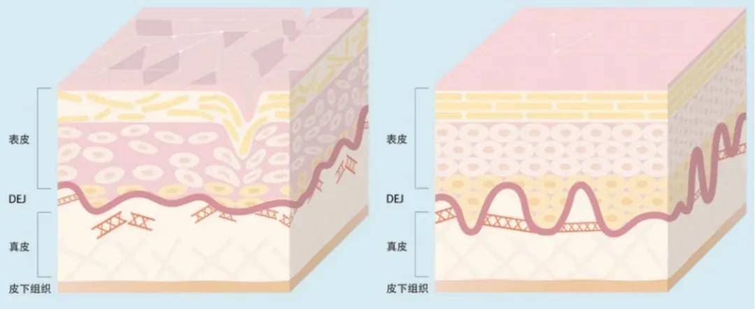 进行能最大限度提升颜值的手段是美白？