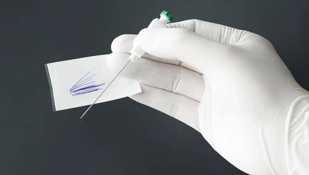 接下来就是见证奇迹的时刻穴位埋线减肥安全有效效果看得见