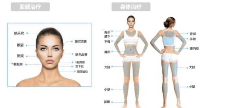 mm神普及：7d聚拉提美容的功效和副作用、原理、危害是什么？