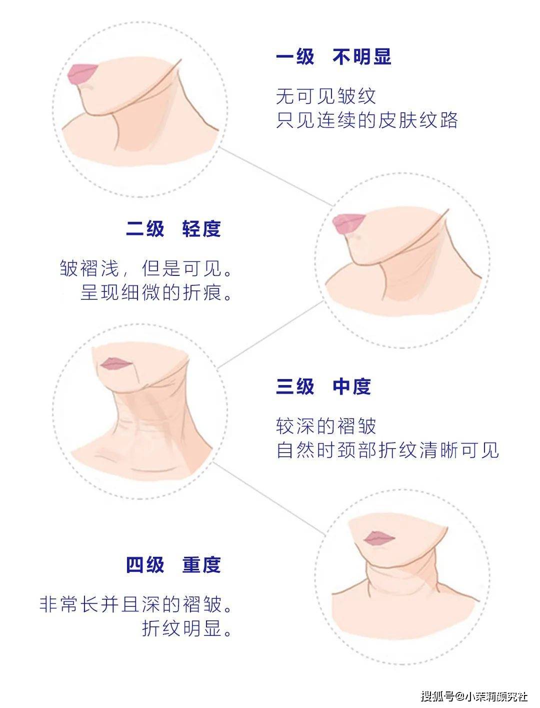 活动别让颈纹暴露了你的年龄！初恋天鹅颈的新生秘诀！！