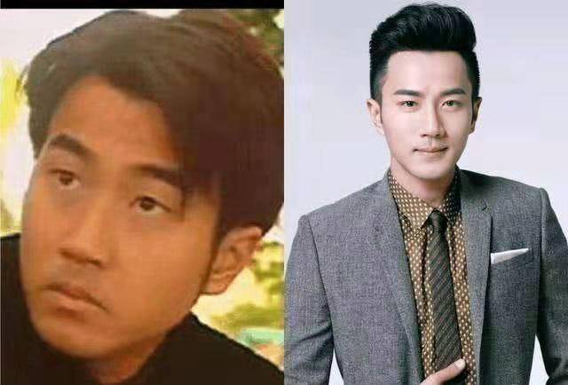 下巴你以为只有女明星酷爱整容？其实男明星整容更疯狂