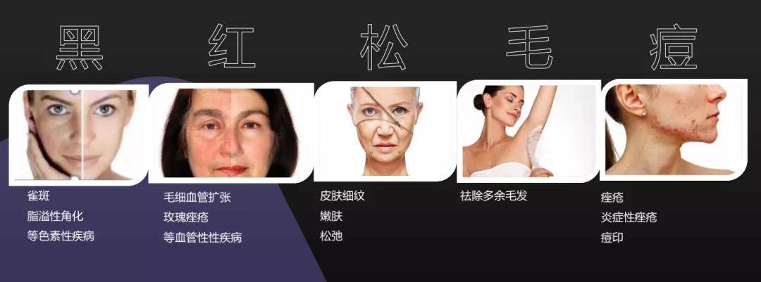 胡萝卜素她全身上下最黑的地方是抹了粉底液的脸？