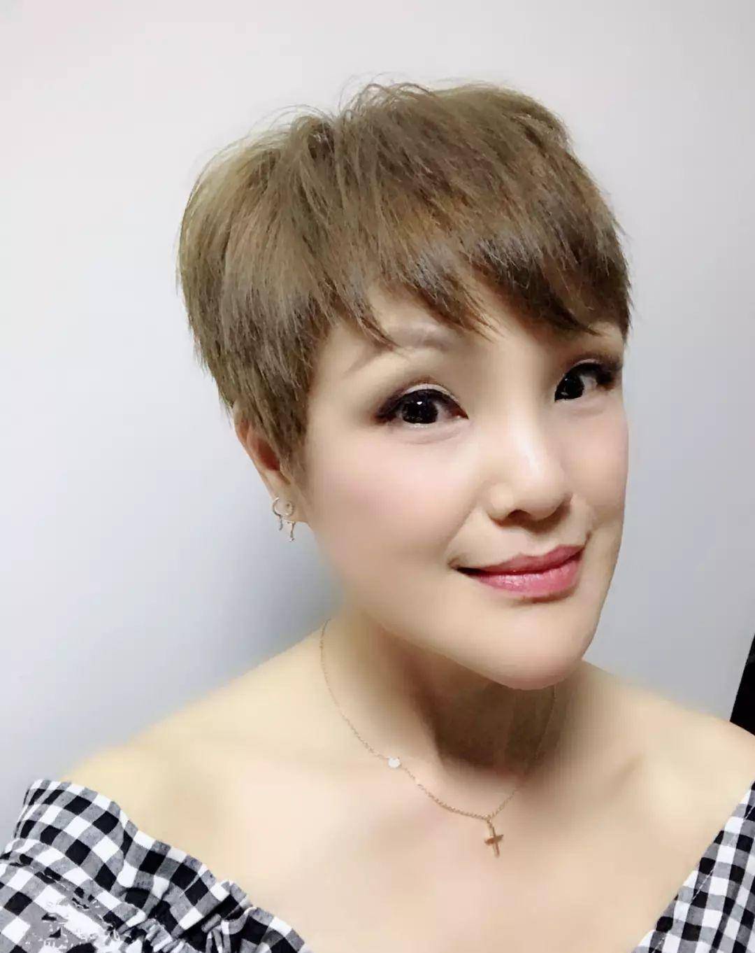 化妆品爱国艺人终于复工了！留疤又如何，她从来不是靠外表！