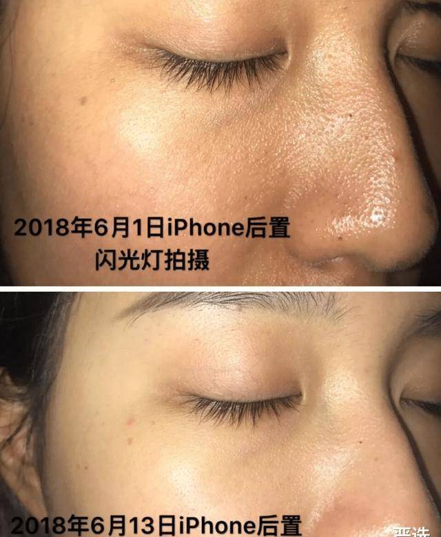 品牌继注射“玻酸”后，又一“抗衰老”方式走红，即安全还方便