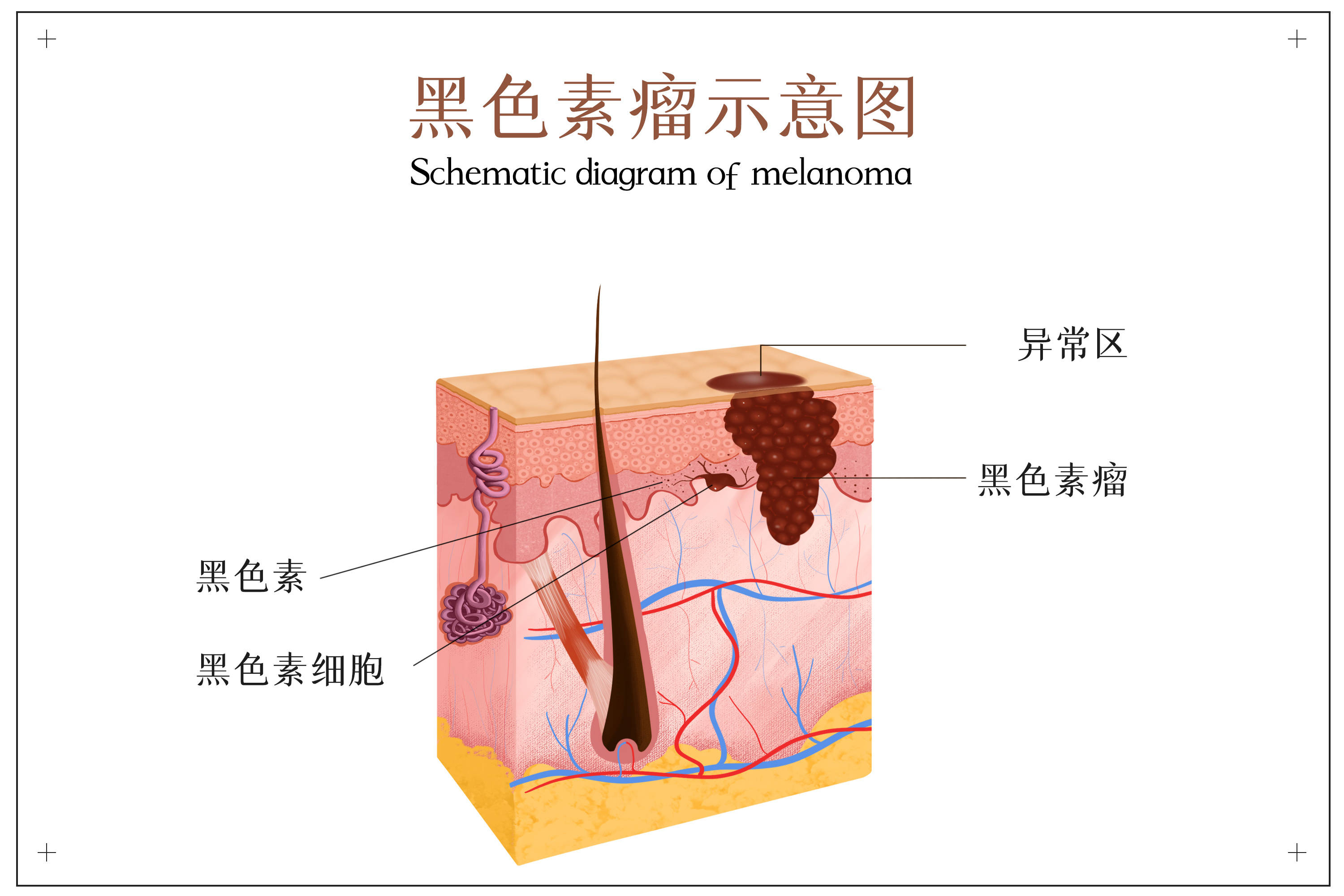 黑色素什么样图片图片