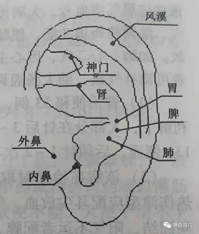 【治疗】取耳穴:脾,胃,肺,肾,内鼻,外鼻,神门,风溪【治则】温运脾肺肾