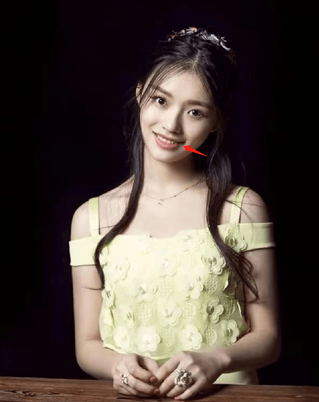 脸部明星整牙后遗症：杨幂脸部松弛，王嘉尔颧骨外扩，宋祖儿法令纹深