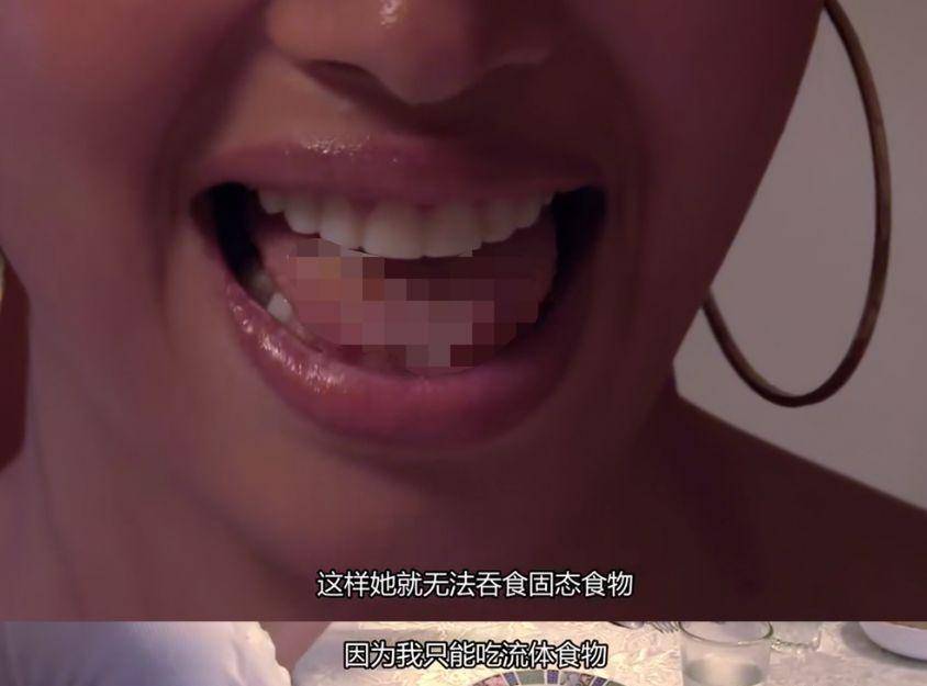 整形未成年整形、在舌头上缝塑料网，为了选美究竟可以多么疯狂？