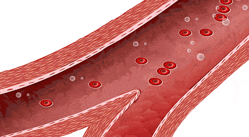 造影|新血管造影技术DVA获FDA批准和CE认证