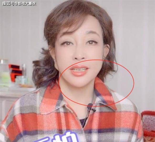 脸部被美容院毁掉的明星，娄艺潇秒变僵尸脸，张檬因整容葬送大好前途