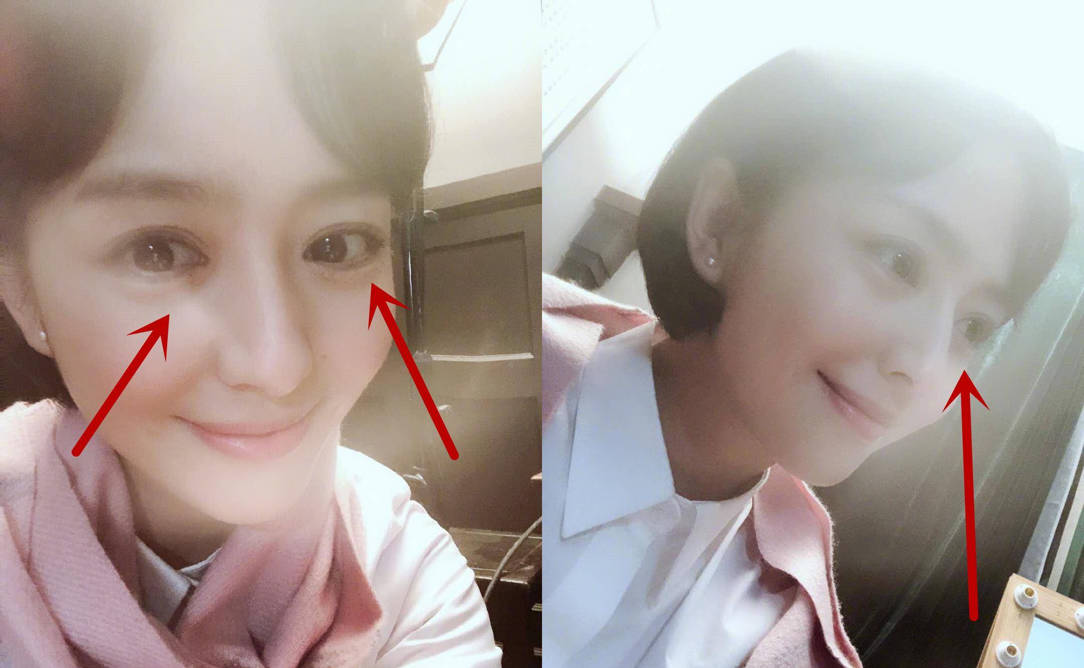 戚薇36岁佟丽娅老成这样?黑眼袋严重吓坏众人,粉丝:丫丫擦下眼霜吧