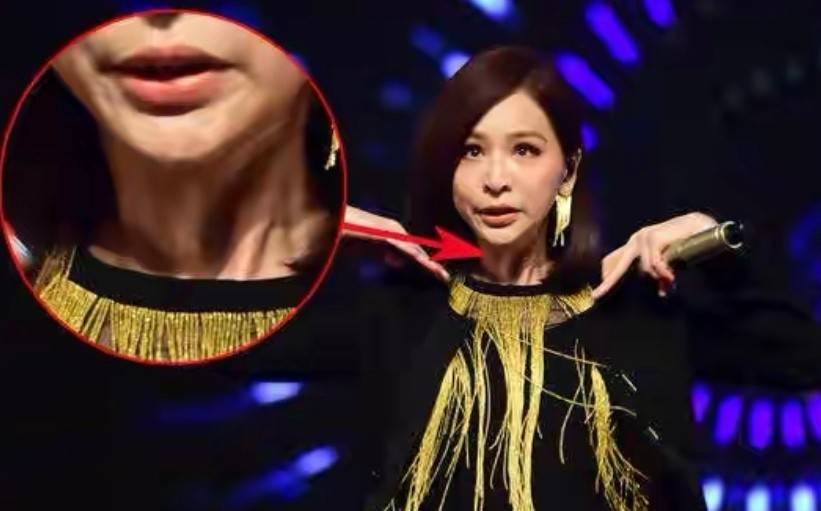 名字面部“爆改”后的7位女星，不说名字你还能认出来吗？